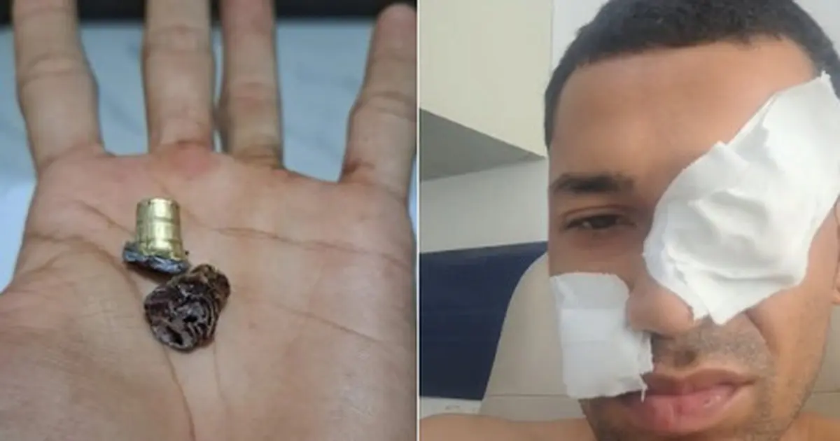 Homem sobrevive a tentativa de homicídio após ser baleado na AL-115, em Arapiraca